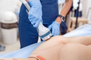 biopolímero en los glúteos