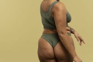 se puede vivir con biopolímeros en los gluteos